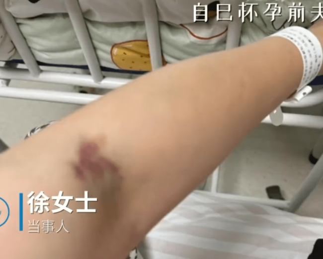 女子称坐月子被丈夫家暴 经警方调解无果独自回娘家准备离婚