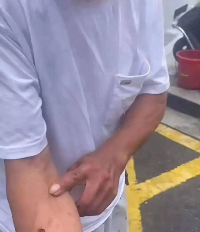 浙江黄包车老人被打后续 双方已经和解，老人获赔380元