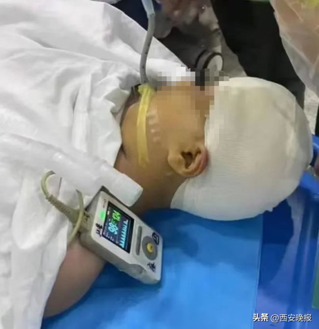 家长称孩子遭残忍打伤 教育局：涉事教师停职接受公安部门调查