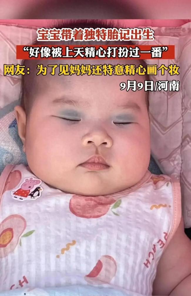 稀奇又可爱！宝宝胎记如同眼影 网友：为见妈妈还特意化个妆