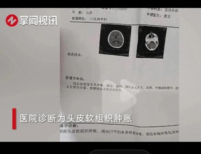 女子上班遭前夫进店持刀殴打 男子连挥数拳后被好心人拉开