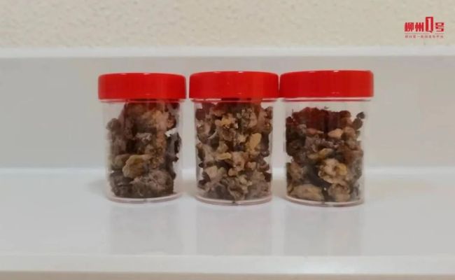 3岁男童贪吃柿子胃里长出胃石 家长们注意了