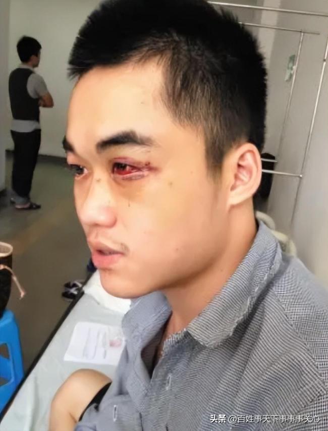 曝河北一13岁男生遭老师殴打致左眼失明：家属索赔300万 公安、教育局已介入调查