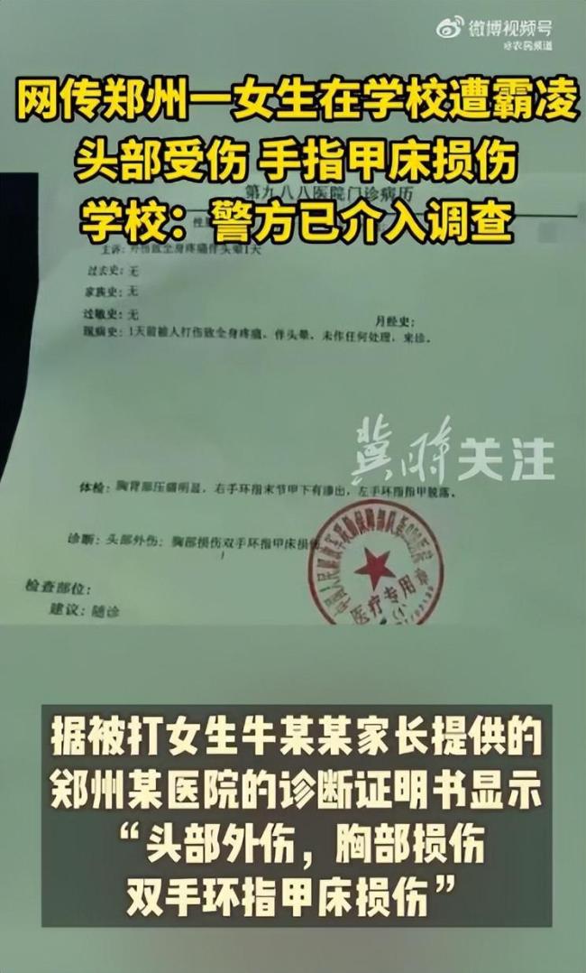 网传河南一女生遭多人霸凌指甲被打脱落 学校称警方已介入调查