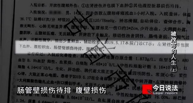 他当时觉得如果自己不反抗很可能就没命了,于是掏出折叠刀乱挥了过去