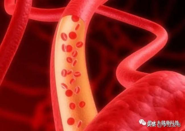 身体这里发硬，竟是死亡前兆？后果将很严重