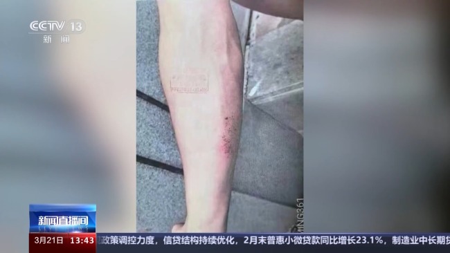 7个月“被撞”70回 辽宁一男子涉保险诈骗被刑拘
