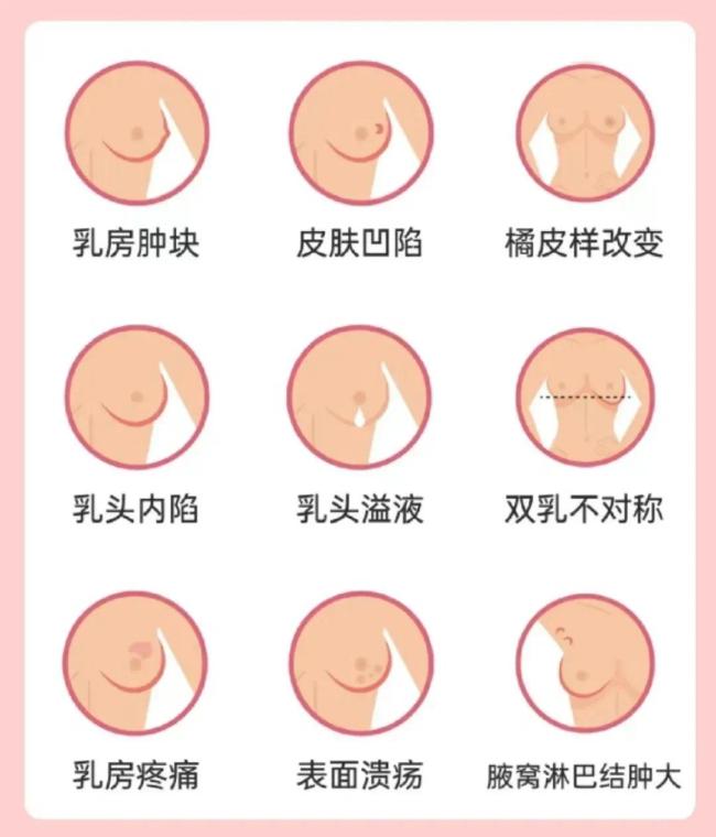 乳房大的女性更易患乳腺癌提醒这6类人才是乳腺癌高发人群早诊早治是