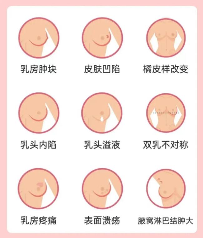 乳房大的女性，更易患乳腺癌？提醒：这6类人才是乳腺癌高发人群，早诊早治是关键