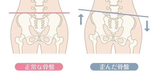 如挤压到子宫,卵巢等生殖器官或膀胱,尿道等泌尿系统,使其产生扭曲
