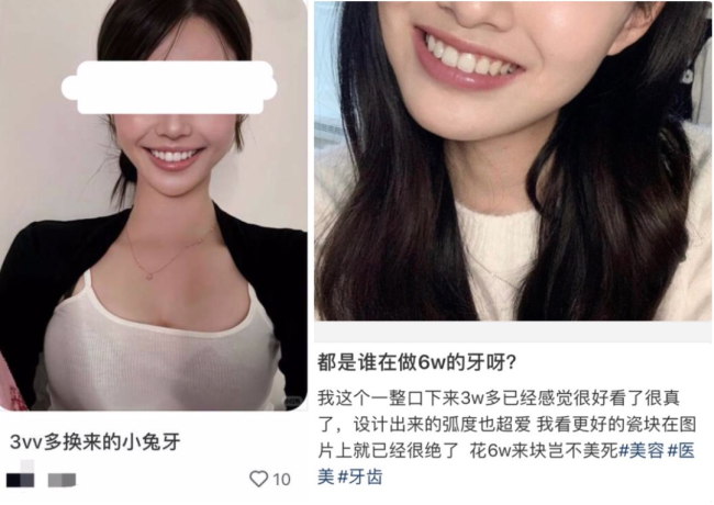 幼态审美盯上女生的牙齿 畸形美感背后的疯狂追捧