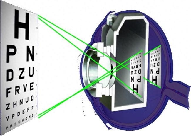 近视、远视、老视……教你来分清 眼球如何调节焦距