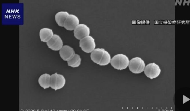 罕见"食人细菌"在日本蔓延 感染后48小时即可致命
