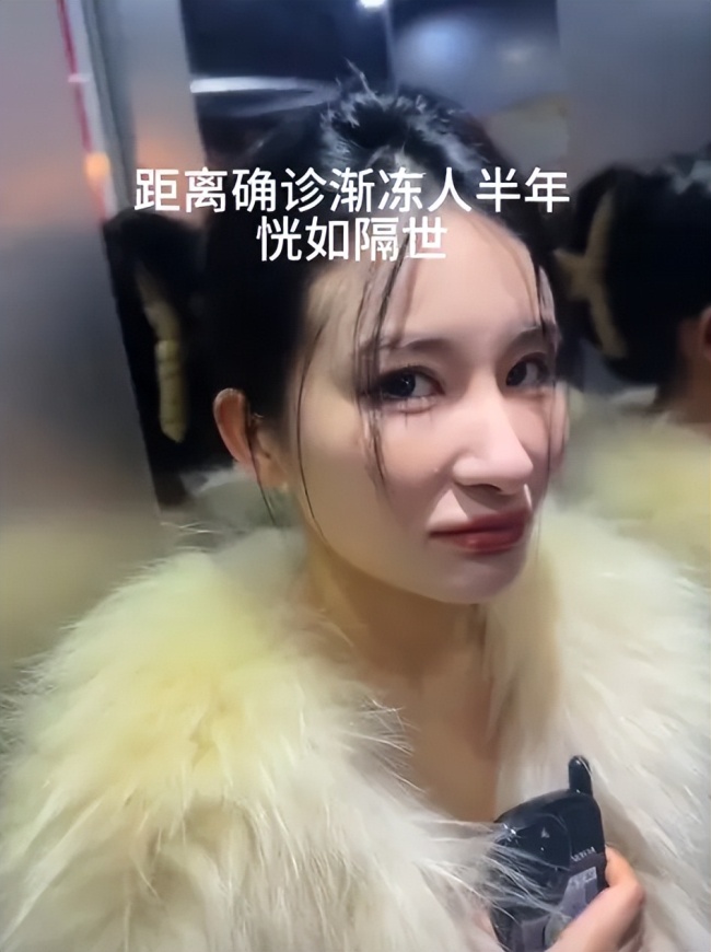 确诊渐冻症后容貌巨变女生求助蔡磊 抗争之路艰难前行