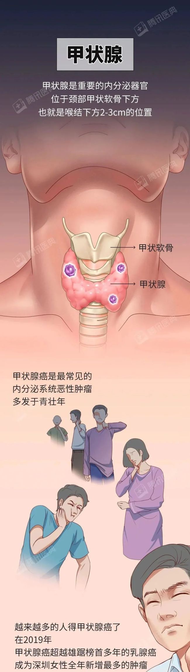 從頭到腳的防癌重點(diǎn)，值得為自己和家人收藏,！