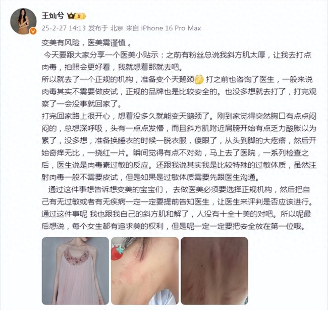 杜淳妻子自曝打肉毒全身過(guò)敏