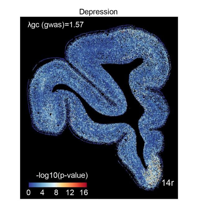 我國(guó)科學(xué)家成功定位抑郁癥相關(guān)細(xì)胞 新方法揭示疾病機(jī)制