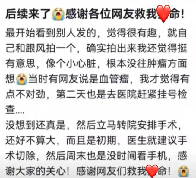 女生晒照被网友看出血管瘤 网友：默默打开手电筒
