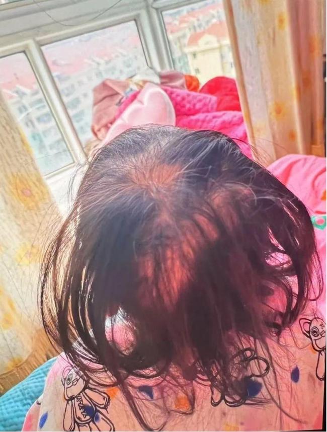 醫(yī)院回應(yīng)3歲女孩鉈中毒：系人為投毒，警方已介入調(diào)查