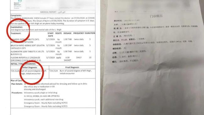 女子乘飛機被熱茶燙傷 航空公司回應(yīng)爭議