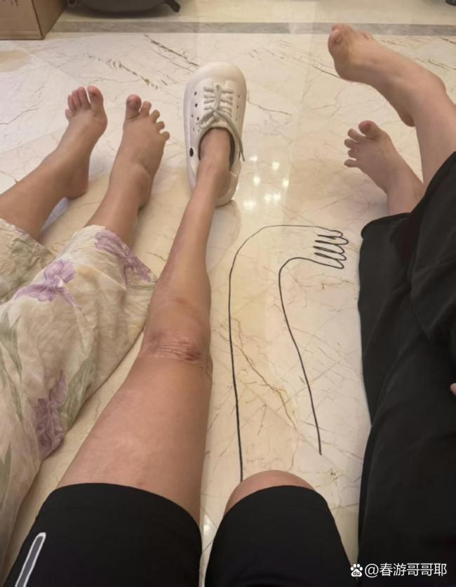 汶川地震亲历者十七年后的独白：好好活着，好好生活！