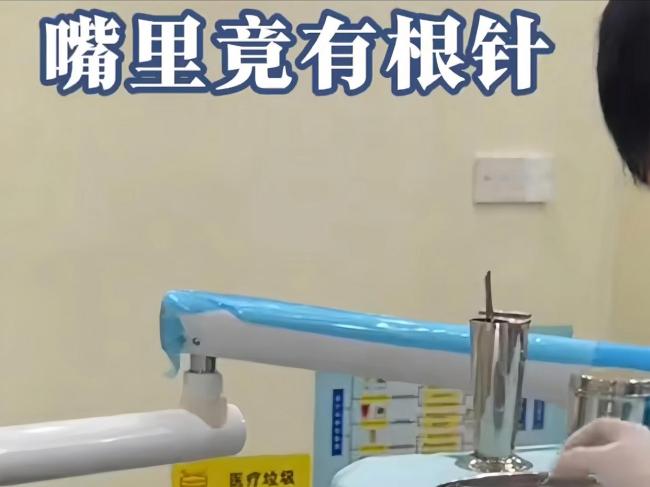女子拔智齒后發(fā)現(xiàn)嘴里有根針 醫(yī)患安全引關(guān)注