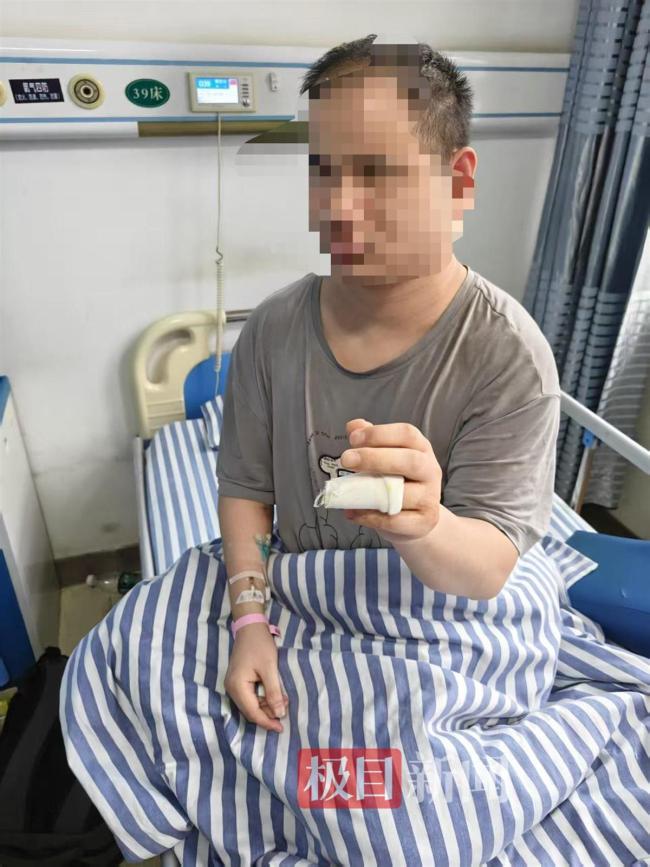 盲人體驗(yàn)小米汽車致手指骨折