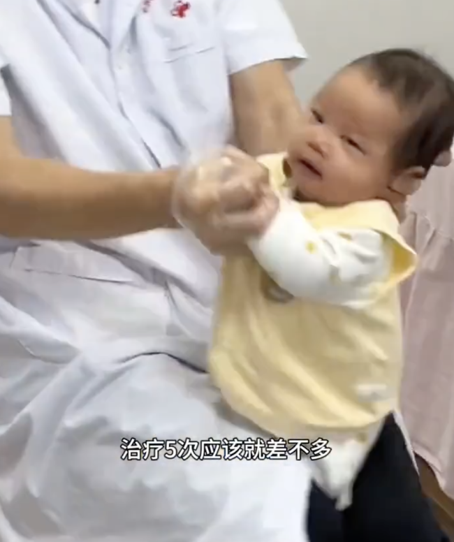 醫(yī)生給斜頸寶寶做治療像揉面團一樣