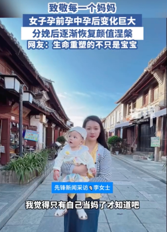 女子分享孕中孕晚分娩后容貌變化 孕激素下的變形記