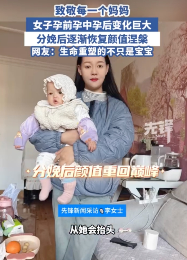 女子分享孕期分娩后容貌變化 孕激素下的變形記