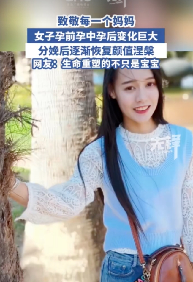 女子分享孕期分娩后容貌變化 孕激素下的變形記