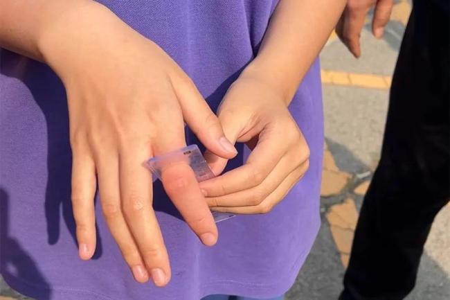 北京密云一女孩手指卡在椅縫中,，消防員緊急破拆救援 近期多起類似事件提醒注意安全