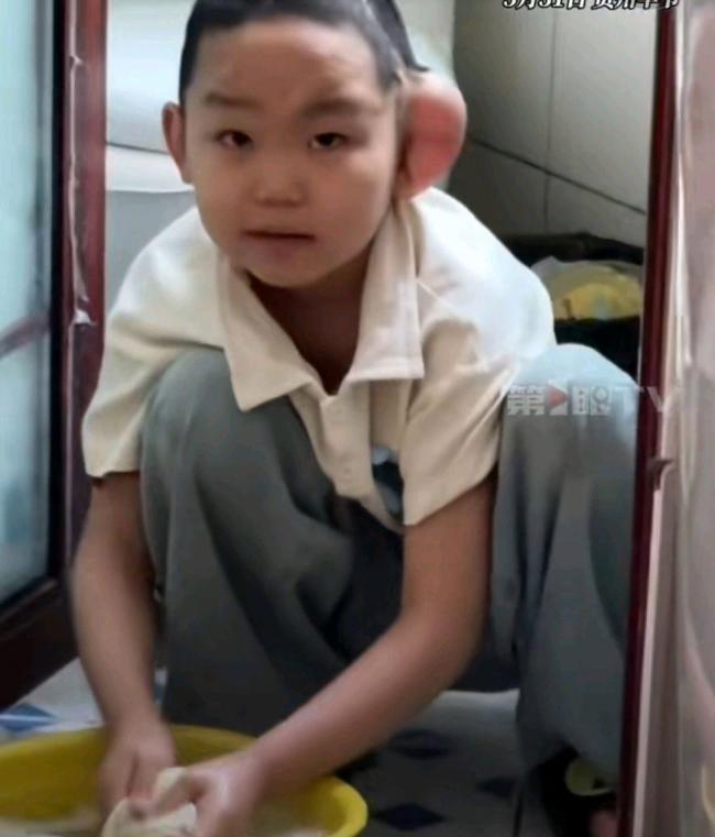 7歲男孩被3只惡犬撕咬一年后近況 仍在艱難康復中