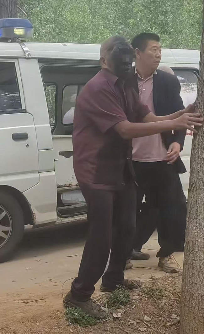 老人撿煙花殘骸被炸黑臉