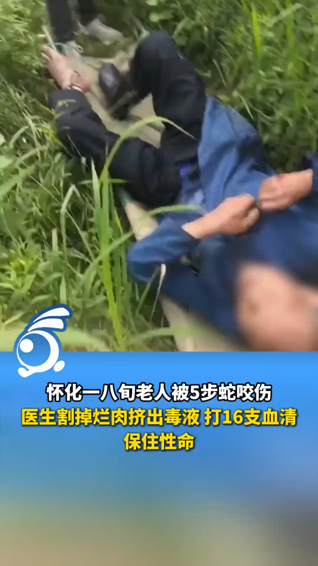 老人被五步蛇咬伤打16支血清保住命 及时救援化险为夷