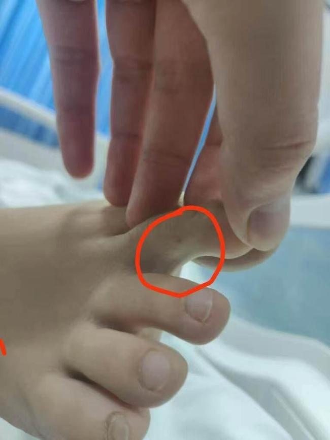 女子疑被蛇咬身亡哪個(gè)環(huán)節(jié)出了問(wèn)題 家屬質(zhì)疑醫(yī)院診治不當(dāng)
