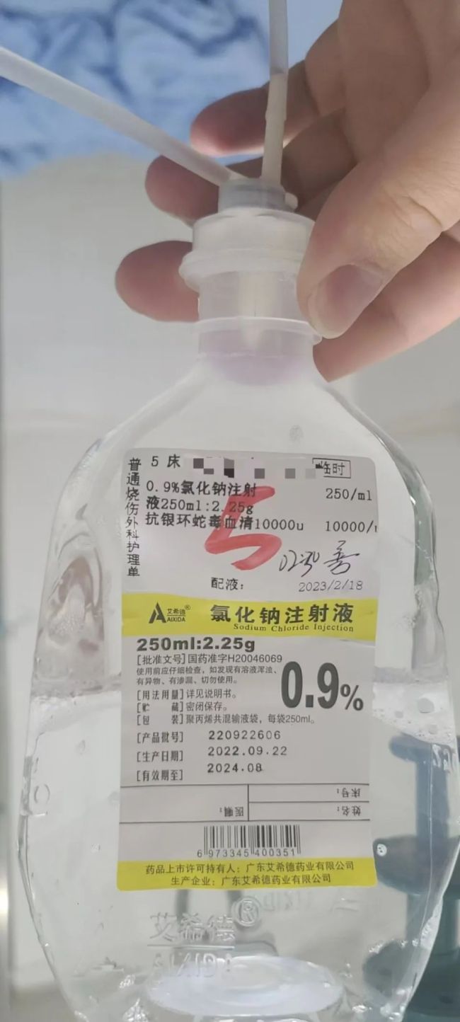 女子簡(jiǎn)述在酒店被毒蛇咬傷 后遺癥持續(xù)兩年