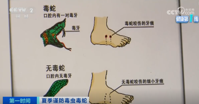 上海醫(yī)院接診蛇咬傷事件增多 如何辨別是否為毒蛇