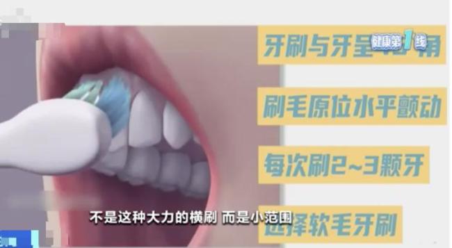 “韦神”的牙齿问题其实很多人都有 牙周炎成健康隐患