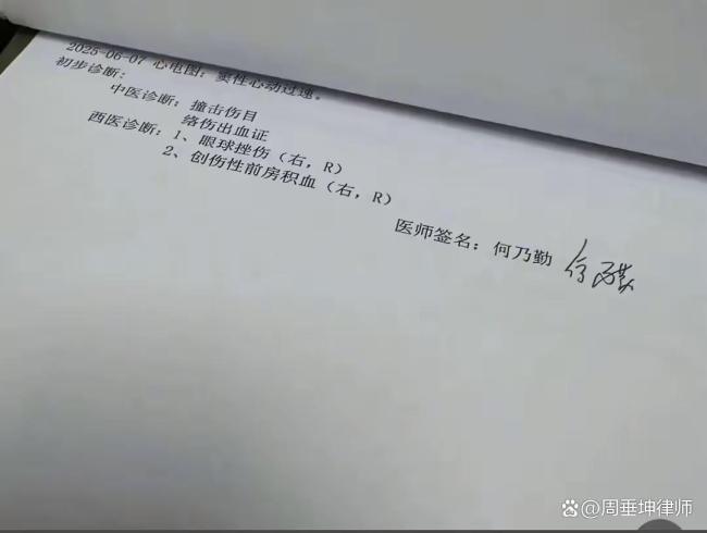 律師分析女孩眼睛遭水槍攻擊失明 游玩變噩夢