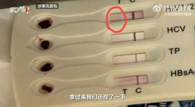 酒店出现疑似艾滋阳性检测盒 情侣紧急就医 事件引发广泛关注