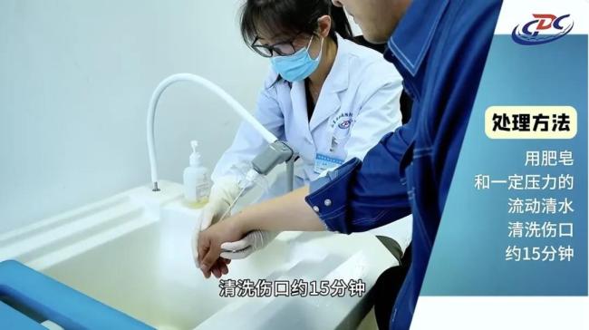 被猫狗抓伤后及时就医 牢记这两步操作