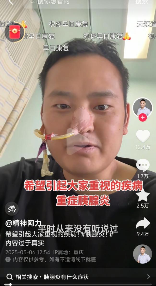  提醒,！男子經(jīng)常暴飲暴食確診胰腺炎
