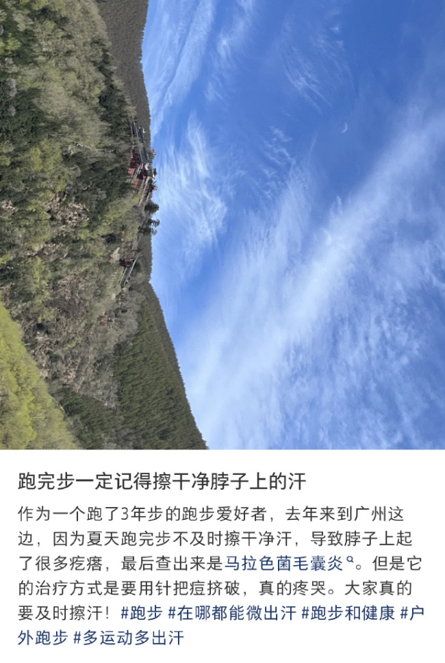 運動后一定要及時擦干凈脖子上的汗