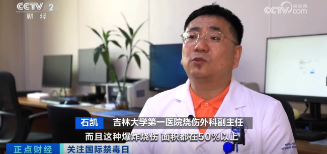 18岁少年全身严重烧伤 只因和朋友“上劲”玩这个