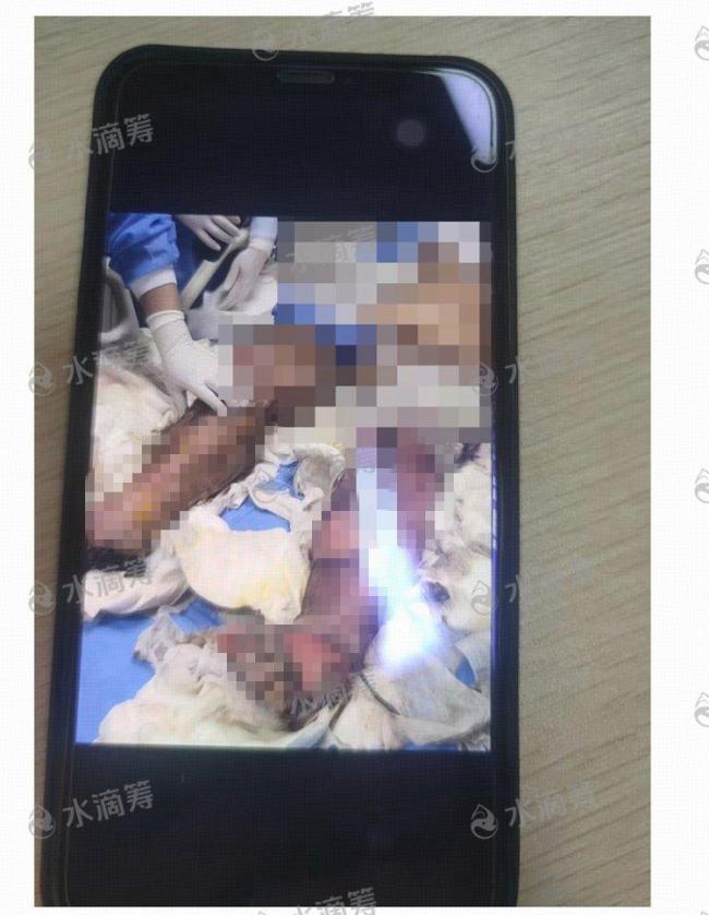 成都一电动车飞线充电起火致1死2伤 悲剧敲响安全警钟