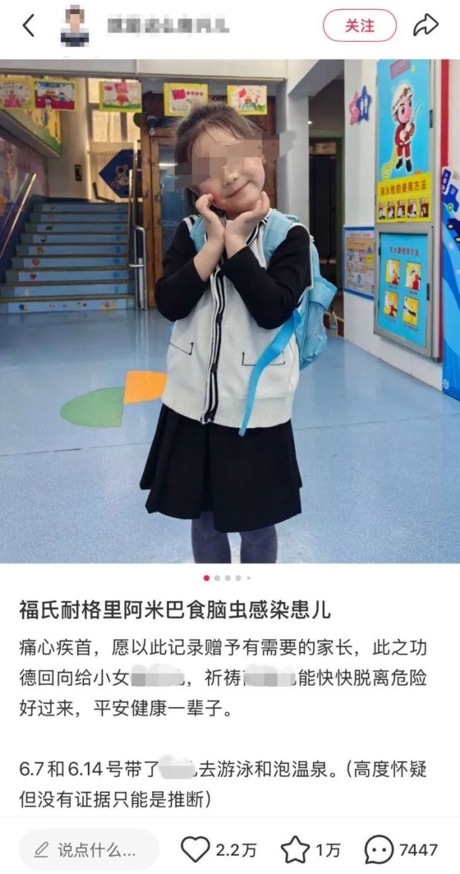 男童高烧不退 张文宏或参与会诊 罕见阿米巴原虫感染引发关注