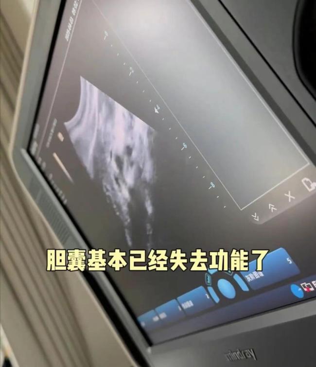 颖儿做了割胆手术 告别30年老友引发热议