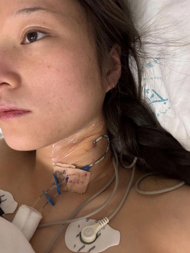 男子開車致女友截癱后失聯(lián) 男友因高額醫(yī)療費逃避責任