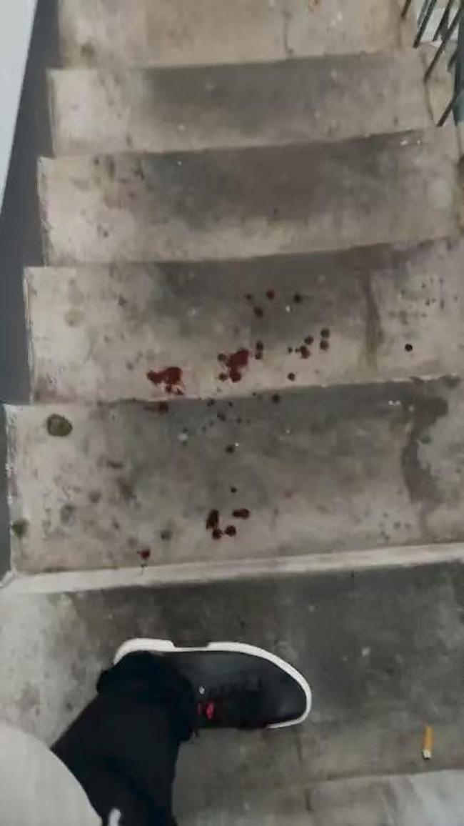 狗未拴繩咬傷人 狗主人拒賠稱訛人